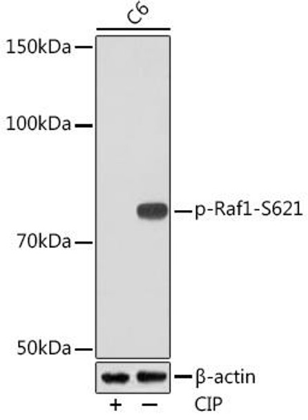 Anti-Phospho-Raf1-S621 Antibody (CABP1011)