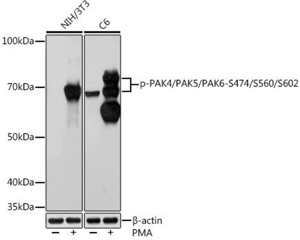 Anti-Phospho-PAK4/PAK5/PAK6-S474/S560/S602 Antibody (CABP1049)