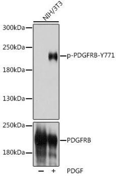 Anti-Phospho-PDGFRB-Y771 Antibody (CABP1062)