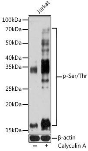 Anti-pan Phospho-Serine/Threonine Antibody (CABP1067)