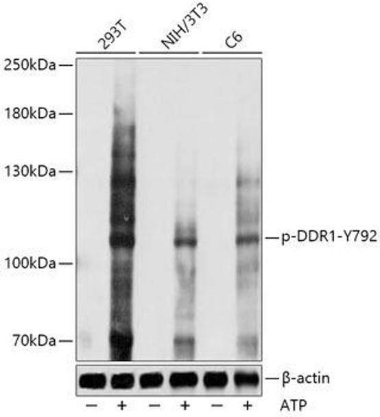 Anti-Phospho-DDR1-Y792 Antibody (CABP1072)