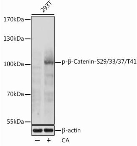 Anti-Phospho-Beta-Catenin-S29/33/37/T41 Antibody (CABP1076)