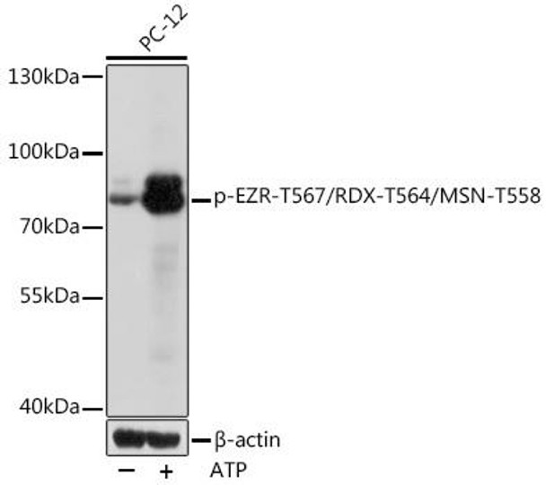 Anti-Phospho-EZR-T567/RDX-T564/MSN-T558 Antibody (CABP1121)