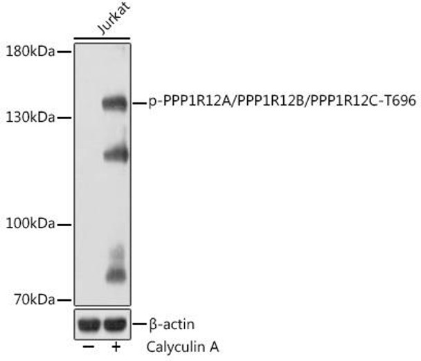 Anti-Phospho-PPP1R12A/PPP1R12B/PPP1R12C-T696 Antibody (CABP1164)