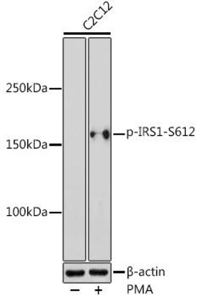 Anti-Phospho-IRS1-S612 Antibody (CABP0553)