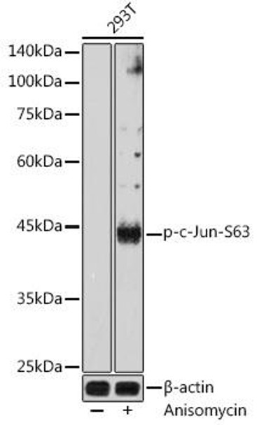 Anti-Phospho-c-Jun-S63 Antibody (CABP1190)