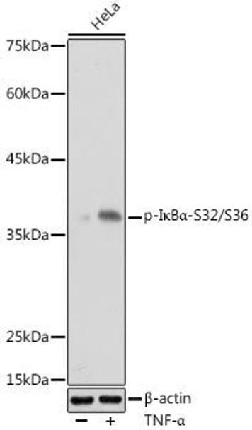 Anti-Phospho-I?Balpha-S32/S36 Antibody (CABP1201)