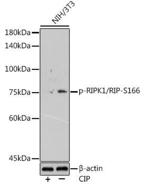 Anti-Phospho-RIPK1/RIP-S166 Antibody (CABP1230)