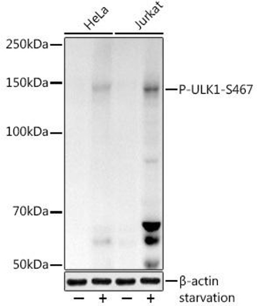 Anti-Phospho-ULK1-S467 Antibody (CABP1262)