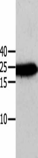 ANXA5 Antibody (PACO13846)