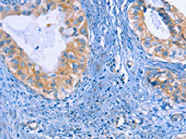 IRF3 Antibody (PACO14593)