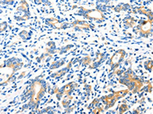 HDC Antibody (PACO14645)