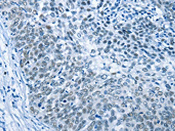 MCM7 Antibody (PACO14693)