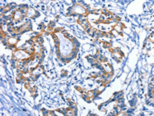 MYH1 Antibody (PACO14744)