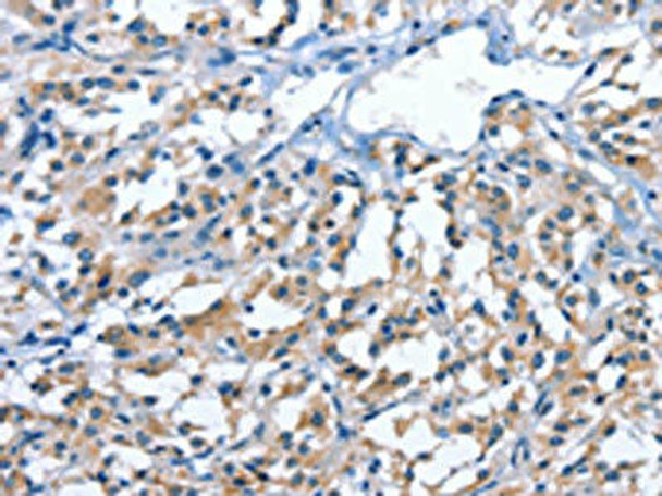 PAK6 Antibody (PACO14836)