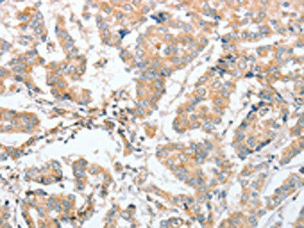 PARD6A Antibody (PACO14841)