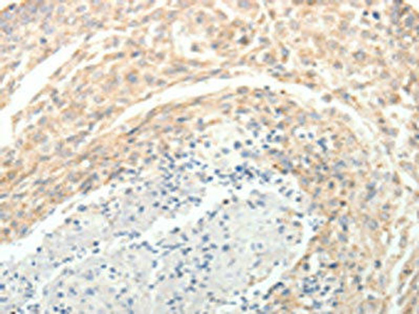 SOCS3 Antibody (PACO15015)