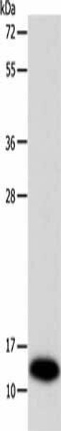 SOD1 Antibody (PACO15018)