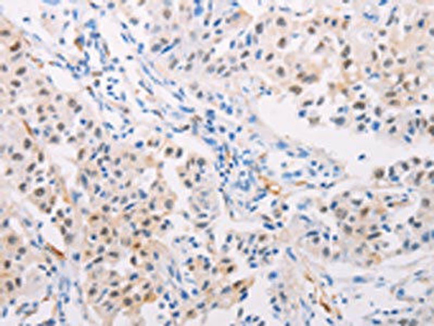 TGM2 Antibody (PACO15103)