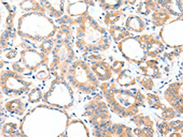 AADACL2 Antibody (PACO15216)