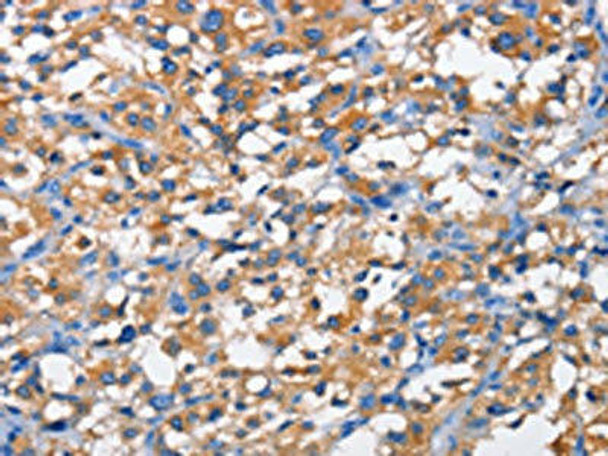 PFKP Antibody (PACO15704)
