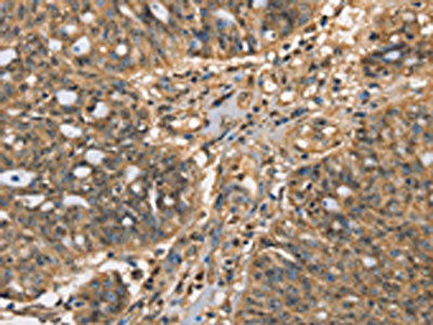 HK3 Antibody (PACO15705)