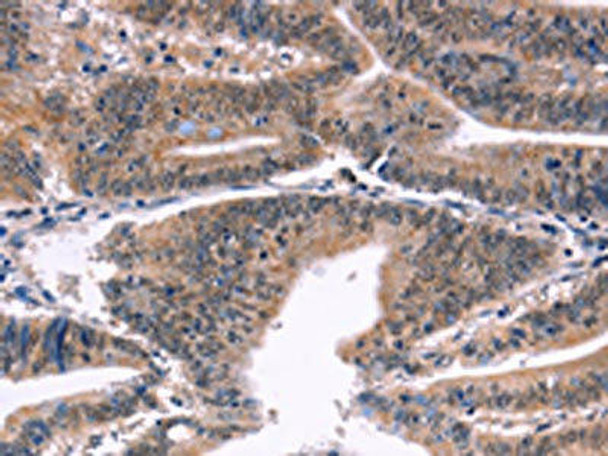 BAP1 Antibody (PACO15744)