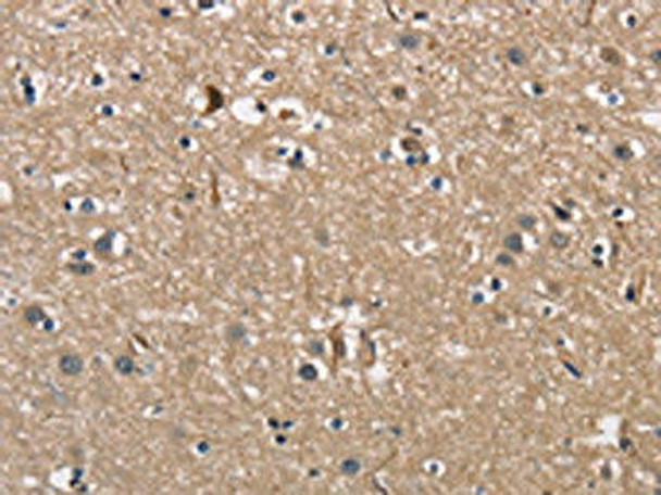 PGK1 Antibody (PACO15757)