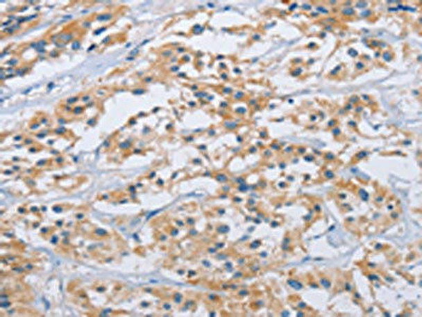 CCR9 Antibody (PACO15945)