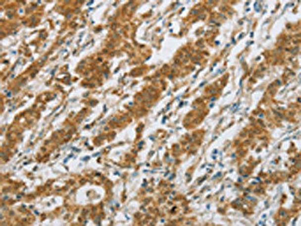 CYP2E1 Antibody (PACO16103)