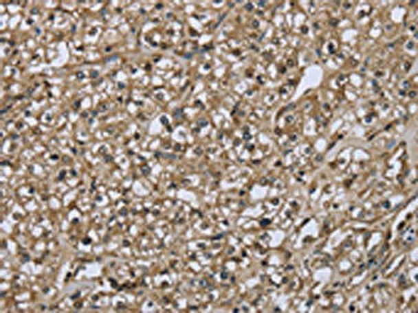 FBP1 Antibody (PACO16326)