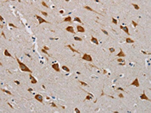 CMC4 Antibody (PACO16710)