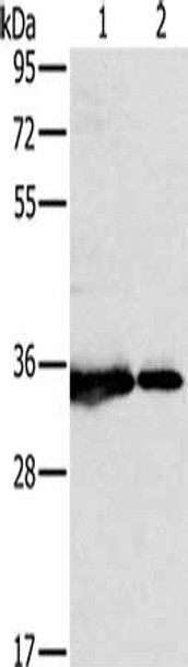 NDUFAF1 Antibody (PACO16744)