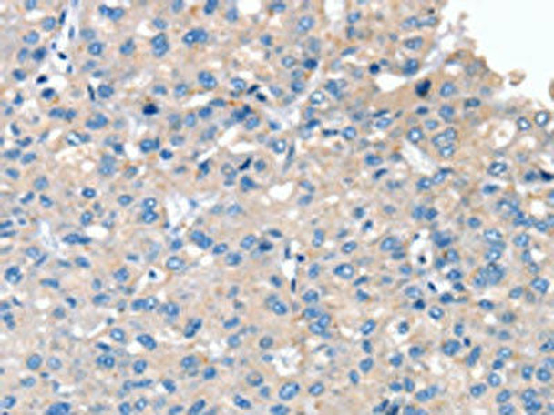 SERPINB2 Antibody (PACO16833)