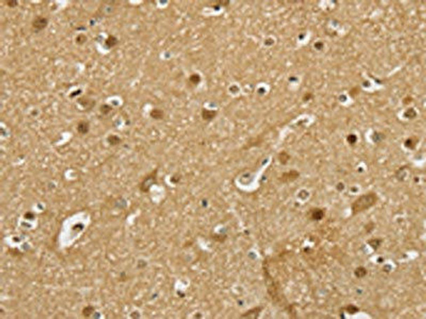 PSMC1 Antibody (PACO16899)