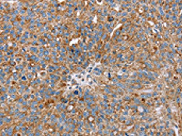 RMDN3 Antibody (PACO16905)