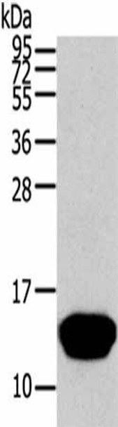 THRSP Antibody (PACO17242)