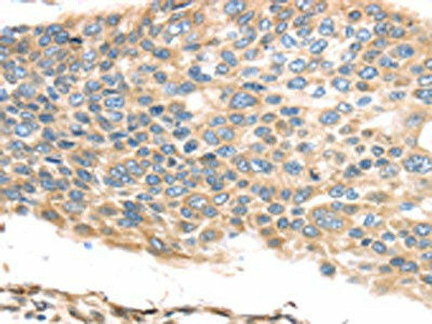 TMED2 Antibody (PACO17269)