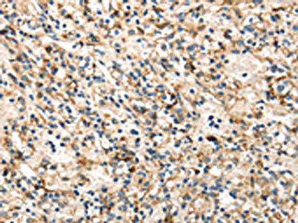 TRIB3 Antibody (PACO17313)