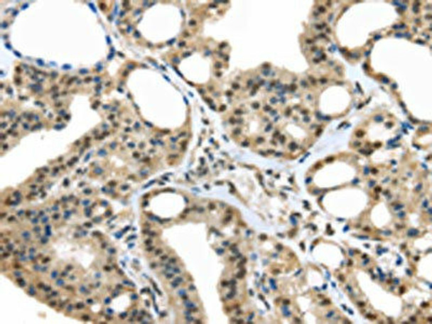 UCHL3 Antibody (PACO17361)