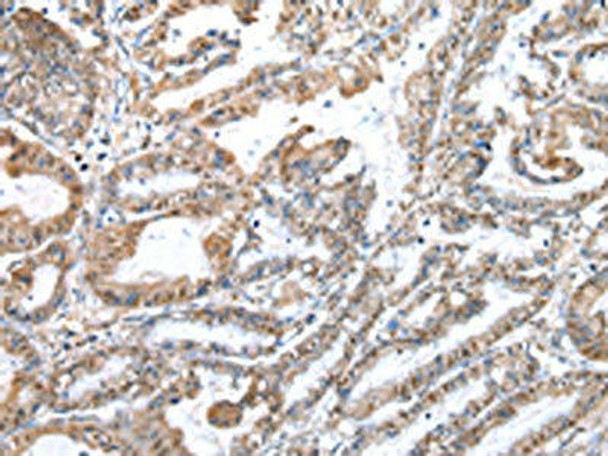 WDR5 Antibody (PACO17450)