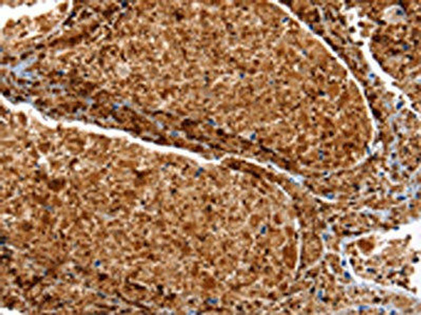 SERPINA3 Antibody (PACO17469)