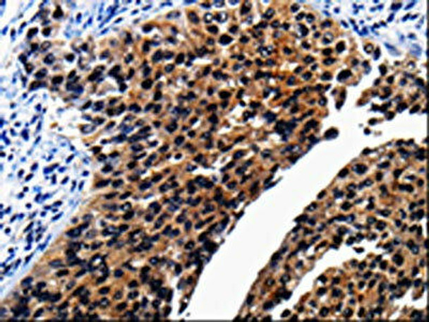 AP1B1 Antibody (PACO17532)