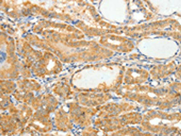 APOB Antibody (PACO17576)