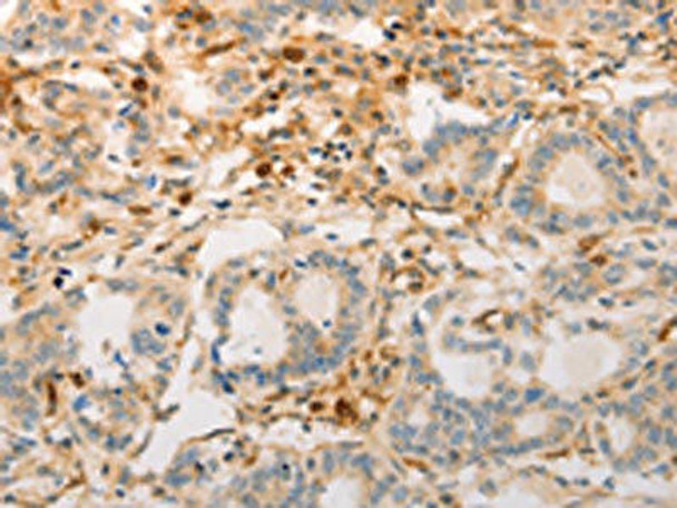 AVPR2 Antibody (PACO17619)