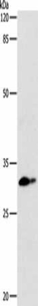 CEBPD Antibody (PACO17686)