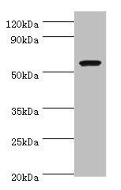 AMY1A Antibody (PACO43124)