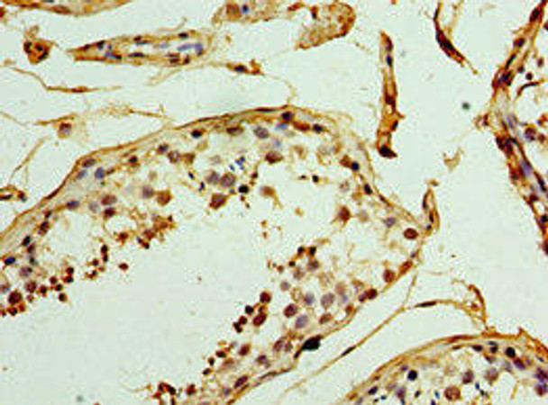UCP1 Antibody (PACO43648)