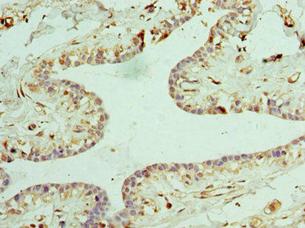 CLTA Antibody (PACO44173)