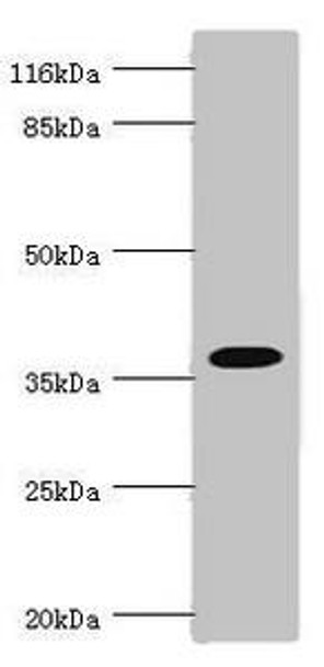 FBP1 Antibody (PACO44189)